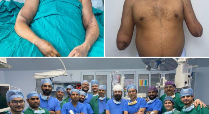 Delhi painter get Hands back as organ donation meets surgical excellence